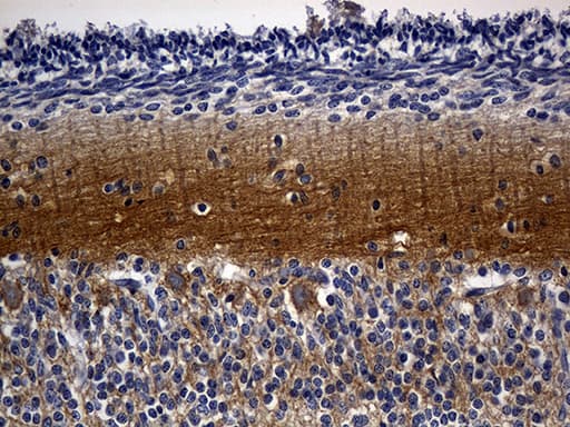 Monoclonal Mouse anti-Human RGS17 / RGSZ2 Antibody (clone OTI8G4, Carrier-free, IHC, WB)