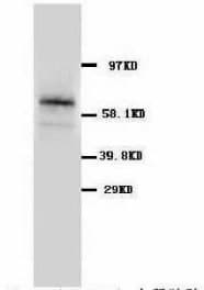 SLC1A3 / EAAT1 Antibody (C-Terminus)