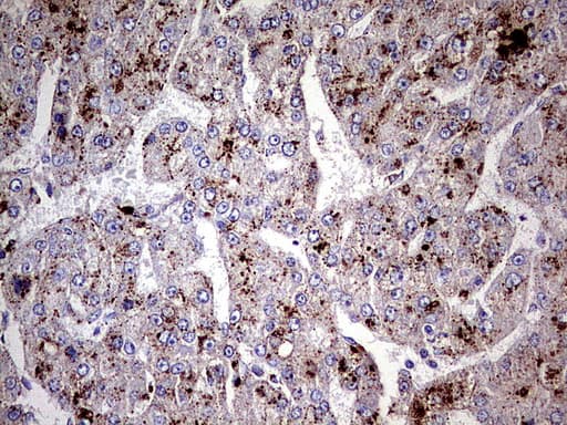 GBA / Glucosidase Beta Acid Antibody (aa40-315, clone UMAB171)