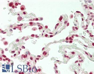 IHC-plus™ Polyclonal Rabbit anti-Human COAA / RBM14 Antibody (aa550-600, IHC, WB)