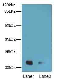 Polyclonal Rabbit anti-Human CRYBA4 Antibody (WB)