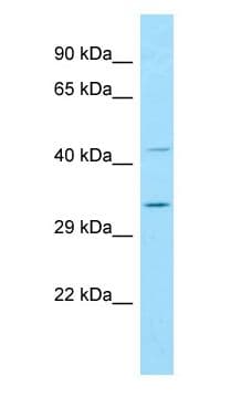 BIN3 Antibody (N-Terminus)