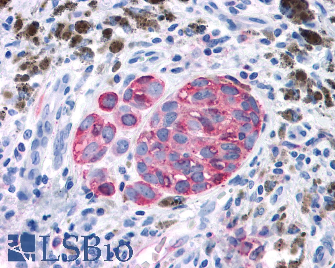 PathPlus™ GPRC6A Antibody (N-Terminus)
