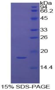 Bovine F9 / Factor IX Protein (Recombinant His)