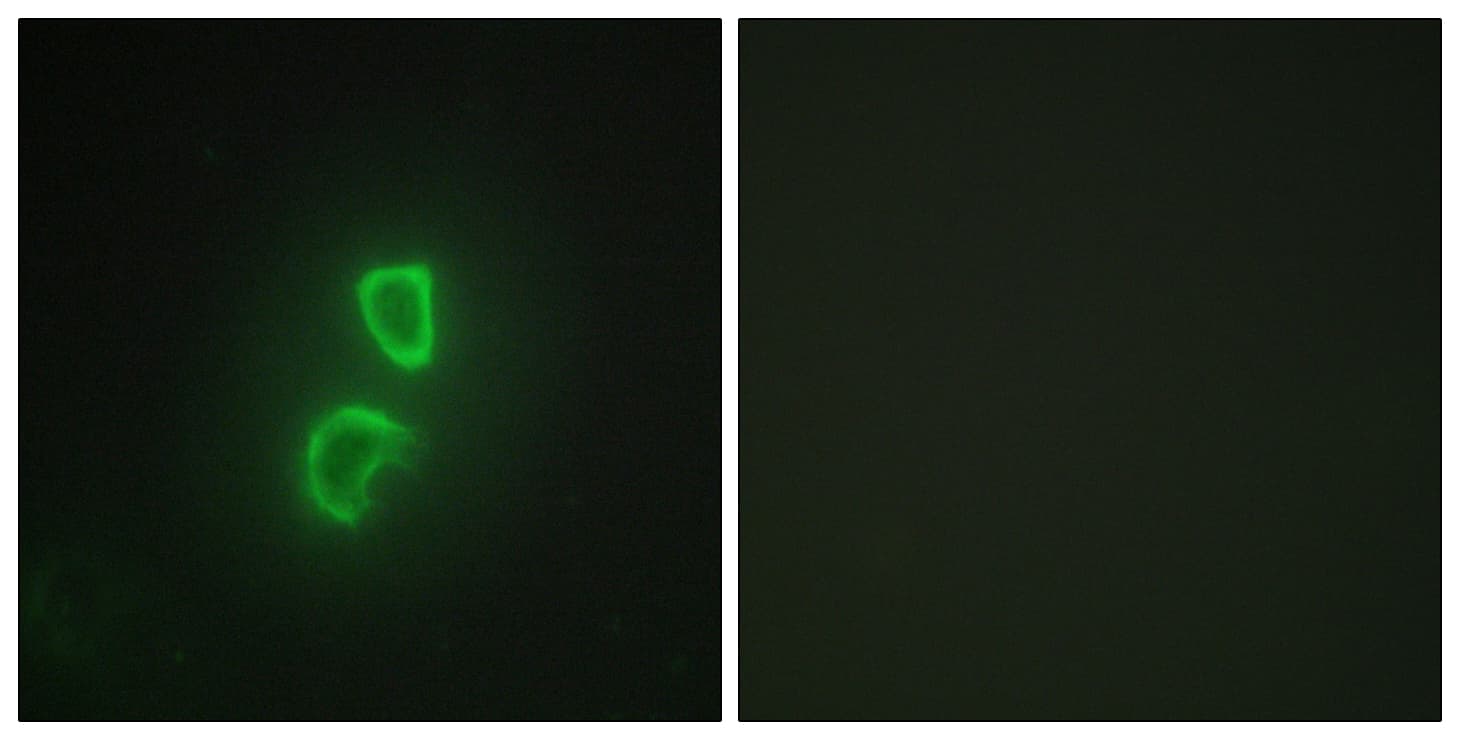 TNFSF11 / RANKL / TRANCE Antibody (aa41-90)