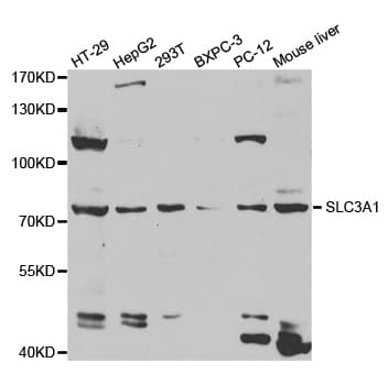 Polyclonal Rabbit anti-Human SLC3A1 / ATR1 Antibody (IHC, IF, WB)