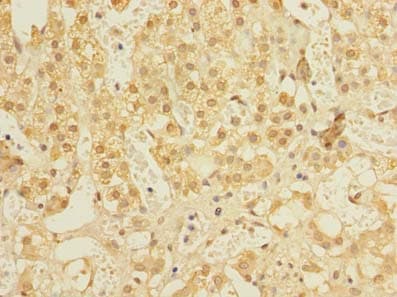 Polyclonal Rabbit anti-Human ALS2CR1 / NIF3L1 Antibody (IHC, WB)