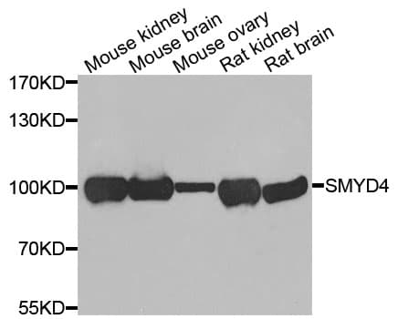 Polyclonal Rabbit anti-Human SMYD4 Antibody (IHC, IF, WB)