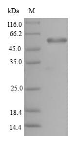 Human PMM2 Protein (Recombinant GST, N-terminus)