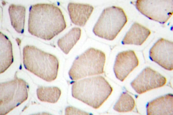 CFLAR / FLIP Antibody (His204)