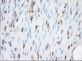 ERCC1 Antibody (clone OTI2A7)
