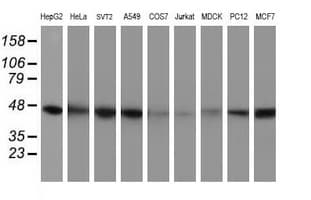 IDH1 / IDH Antibody (clone OTI1D1)