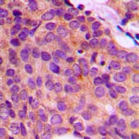 IHC-plus™ KRT17 / CK17 / Cytokeratin 17 Antibody (C-Terminus)