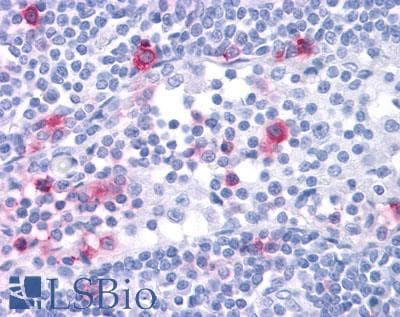 PathPlus™ CCR4 Antibody (C-Terminus)