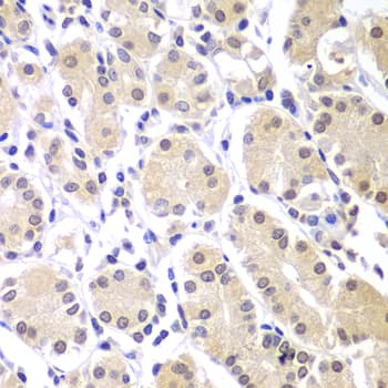 CHEK1 / CHK1 Antibody