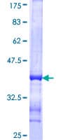 Human SYN2 / Synapsin II Protein (Recombinant GST, N-terminus)