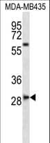 Polyclonal Rabbit anti-Human SLAMF8 Antibody (aa256-285, WB)