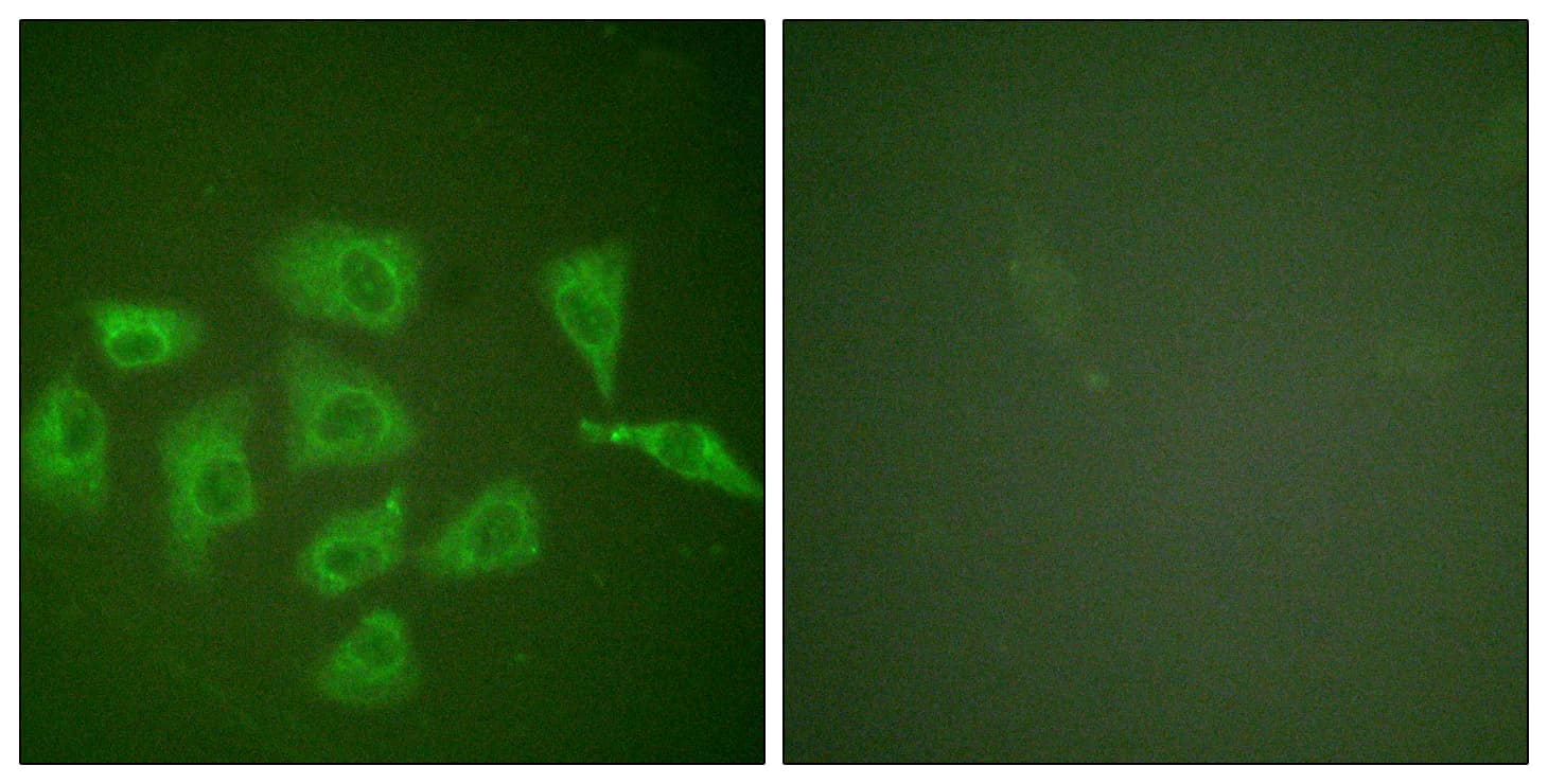NTRK1 / TrkA Antibody (aa747-796)