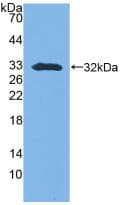 SFN / Stratifin / 14-3-3 Sigma Antibody (aa1-249)