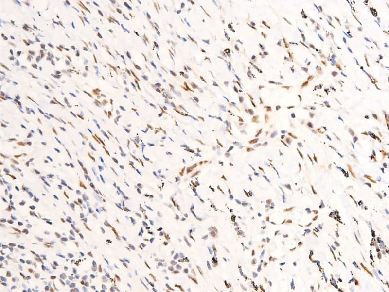 ERBB2 / HER2 Antibody (phospho-Tyr1248)