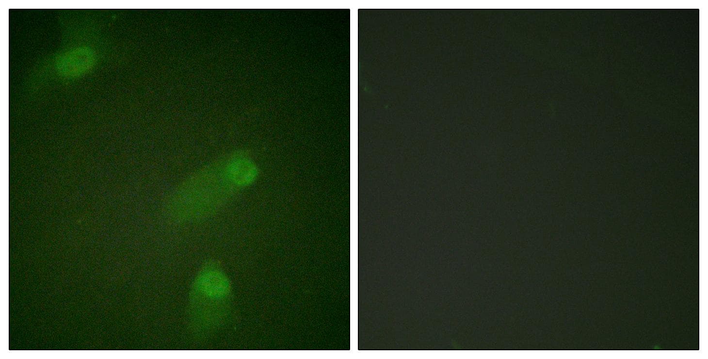 NFKB1 / NF-Kappa-B Antibody (p927)