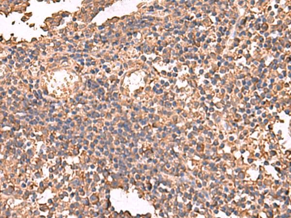 LDHAL6B Antibody