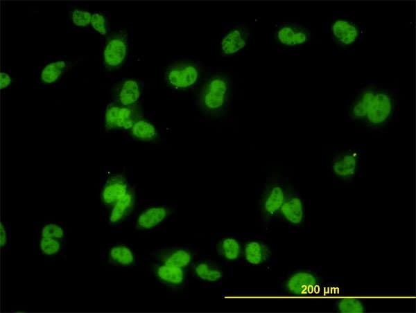MED31 Antibody (clone 2C8)