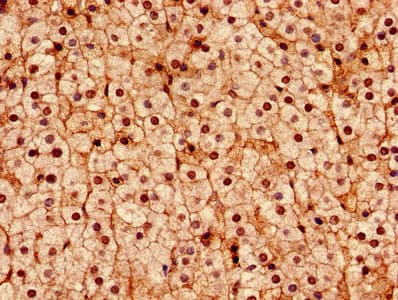 Polyclonal Rabbit anti-Human DDX3 / DDX3X Antibody (aa2-662, IHC, WB)