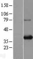 SIX1 Protein (Over-Expression Lysate Myc-DDK (Flag))