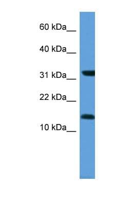 MGST3 Antibody (aa25-74)