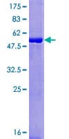 Human SSC4D / SRCRB4D Protein (Recombinant GST)