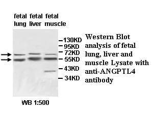 Polyclonal Rabbit anti-Human ANGPTL4 Antibody (aa251-406, IHC, WB)