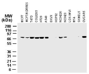 Polyclonal Rabbit anti-Human BIRC2 / cIAP1 Antibody (aa158-175, IHC, WB)
