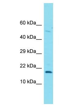 FOXL2NB Antibody (aa57-106)
