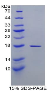 Human RBP1 / CRBP Protein (Recombinant His)