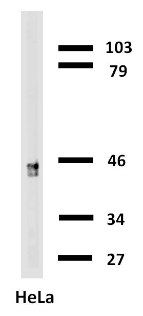 IHC-plus™ Monoclonal Mouse anti-Human KRT18 / CK18 / Cytokeratin 18 Antibody (clone C-04, Biotin, IHC, WB)