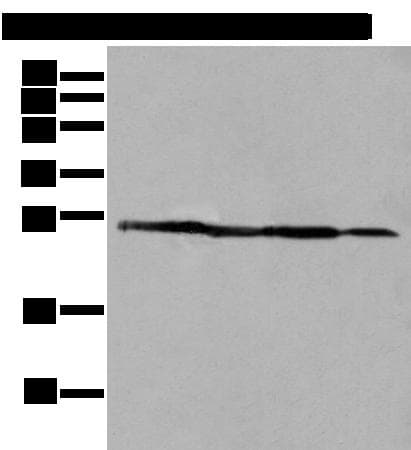 ARHGDIB / D4 GDI Antibody