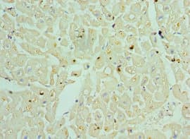 TDG / Thymine DNA Glycosylase Antibody (aa141-410)