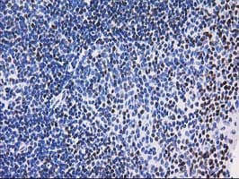 MEF2C Antibody (clone OTI2D2)