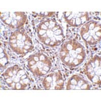 Polyclonal Rabbit anti-Human RASD2 Antibody (IHC, IF, WB)