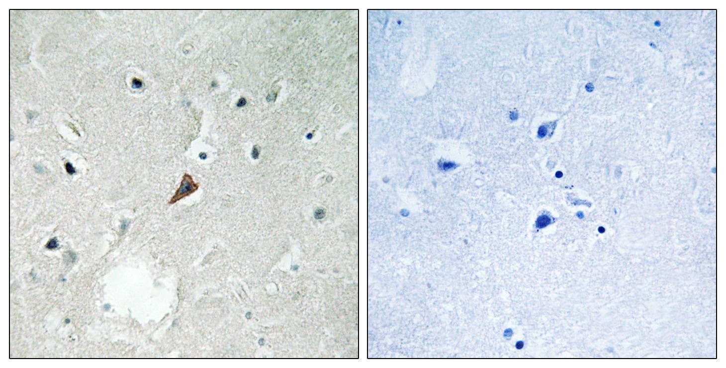 PTK2B / PYK2 Antibody (phospho-Tyr579)