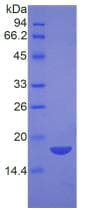 Human NPM1 / NPM / Nucleophosmin Protein (Recombinant His)