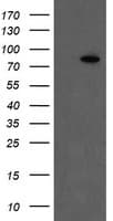 F13A1 / Factor XIIIa Antibody (clone OTI9E2)