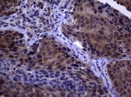 PIK3C2A Antibody (aa230-560, clone OTI2C11)