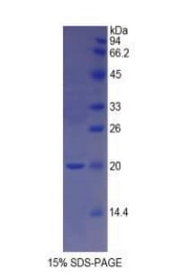 Rat GDF1 Protein (Recombinant His)