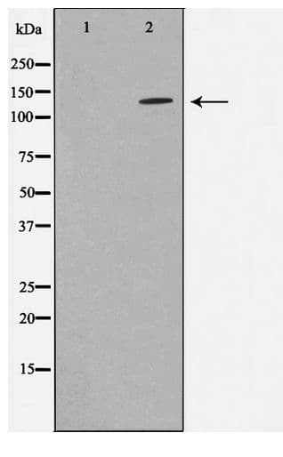 Polyclonal Rabbit anti-Human ADNP Antibody (WB)