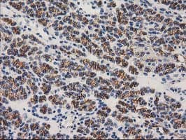 CTNNB1 / Beta Catenin Antibody (clone OTI12H7)