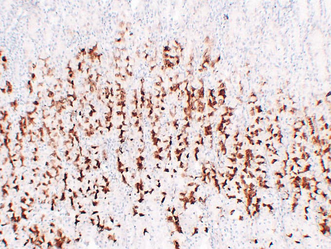 MUC6 / MUC-6 Antibody (clone ABT-MUC6)