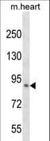IHC-plus™ Polyclonal Rabbit anti-Human KLHL1 Antibody (aa1-30, IHC, WB)