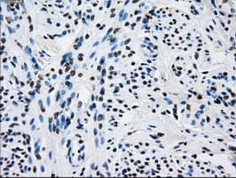 RPA2 / RFA2 / RPA34 Antibody (clone OTI8B3)